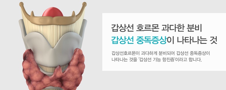 갑상선 사진.jpg